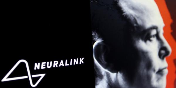 Elon Musk’s Neuralink Opens Its Doors for Brain Implant Human Trials