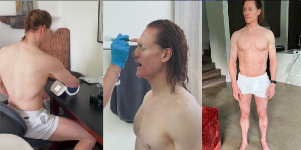 Millionaire Biohacker‘s Nighttime Erections Fuel Rising Prediction Market Bet